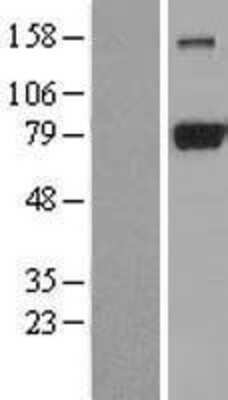 Western Blot: DRP1 Overexpression Lysate [NBL1-09967]