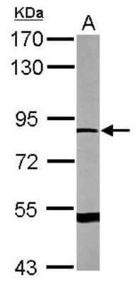 Western Blot: DRP2 Antibody [NBP2-16229]