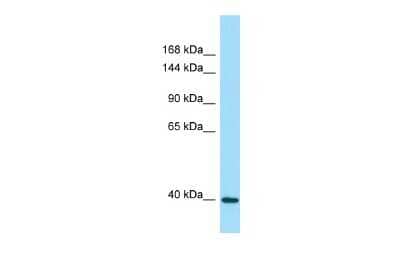 Western Blot: DRP2 Antibody [NBP2-84822]