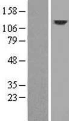 Western Blot: DRP2 Overexpression Lysate [NBP2-08164]