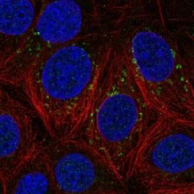 Immunocytochemistry/ Immunofluorescence: DSCAM Antibody [NBP3-17835]