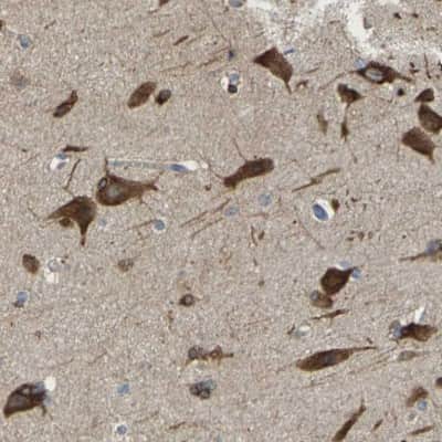 Immunohistochemistry-Paraffin: DSCAM Antibody [NBP2-30716]