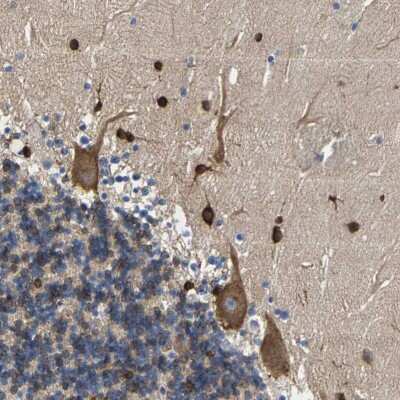 Immunohistochemistry-Paraffin: DSCAM Antibody [NBP2-30716]