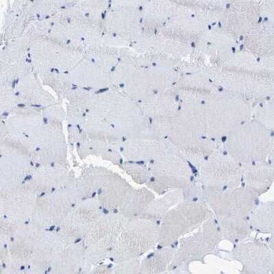 Immunohistochemistry-Paraffin: DSCAM Antibody [NBP2-30716]