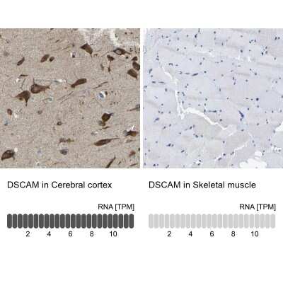 Immunohistochemistry-Paraffin: DSCAM Antibody [NBP2-30716]