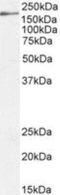 Western Blot: DSCAM Antibody [NB100-41390]