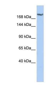 Western Blot: DSCAM Antibody [NBP1-59208]