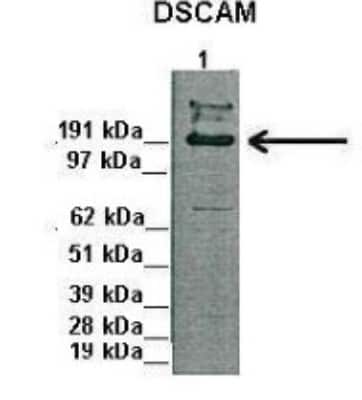 Western Blot: DSCAM Antibody [NBP1-59208]