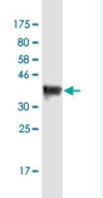 Western Blot: DSCAM-L1 Antibody (6B10) [H00057453-M01-100ug]