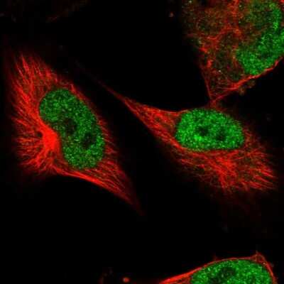 Immunocytochemistry/ Immunofluorescence: DSCC1 Antibody [NBP2-58607]
