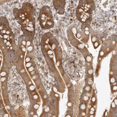 Immunohistochemistry-Paraffin: DSCC1 Antibody [NBP2-33275]