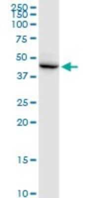 Western Blot: DSCC1 Antibody [H00079075-B01P]