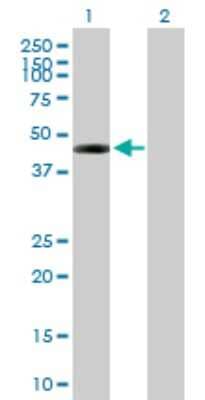 Western Blot: DSCC1 Antibody [H00079075-B01P]
