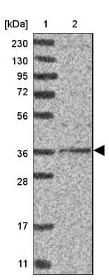 Western Blot: DSCC1 Antibody [NBP2-33275]