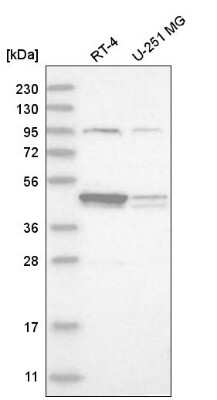 Western Blot: DSCC1 Antibody [NBP2-58607]