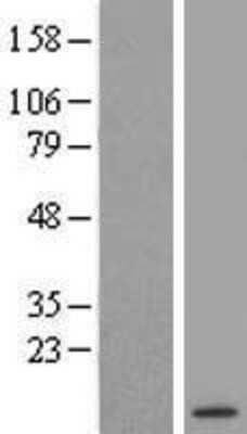 Western Blot: DSCR10 Overexpression Lysate [NBL1-10023]