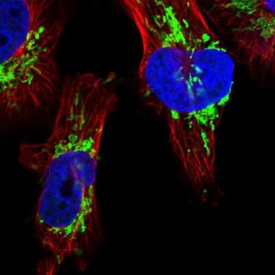 Immunocytochemistry/ Immunofluorescence: DSCR3 Antibody [NBP1-84296]