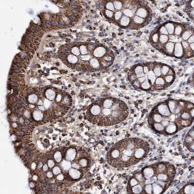 Immunohistochemistry-Paraffin: DSCR3 Antibody [NBP1-84296]