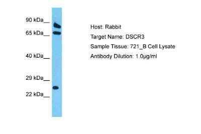 Western Blot: DSCR3 Antibody [NBP2-82928]