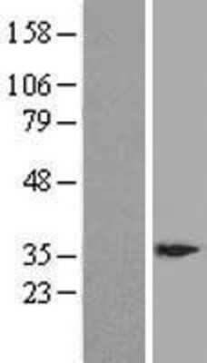 Western Blot: DSCR3 Overexpression Lysate [NBL1-10024]