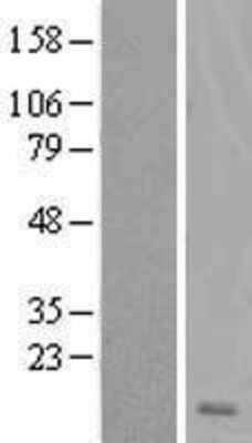 Western Blot: DSCR4 Overexpression Lysate [NBL1-10025]