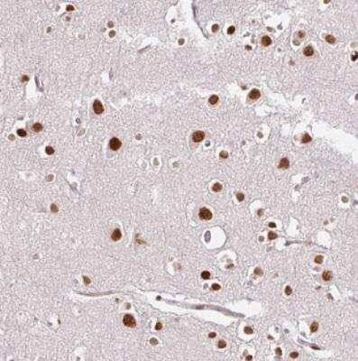 Immunohistochemistry: DSCR6 Antibody [NBP2-31034]