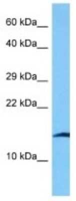 Western Blot: DSCR6 Antibody [NBP3-10854]