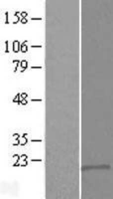 Western Blot: DSCR9 Overexpression Lysate [NBL1-10026]