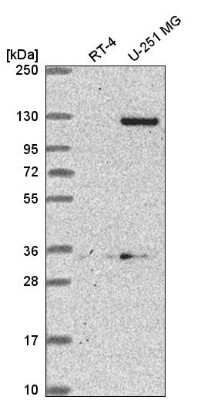 Western Blot: DSEL Antibody [NBP2-56370]