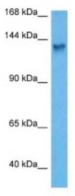 Western Blot: DSEL Antibody [NBP3-10982]