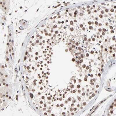 Immunohistochemistry-Paraffin: DSN1 Antibody [NBP1-88302]
