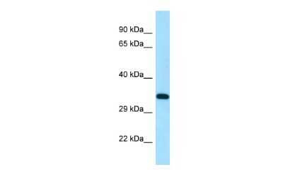 Western Blot: DSN1 Antibody [NBP2-87303]