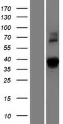 Western Blot: DSN1 Overexpression Lysate [NBP2-06273]