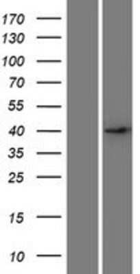 Western Blot: DSN1 Overexpression Lysate [NBP2-09738]