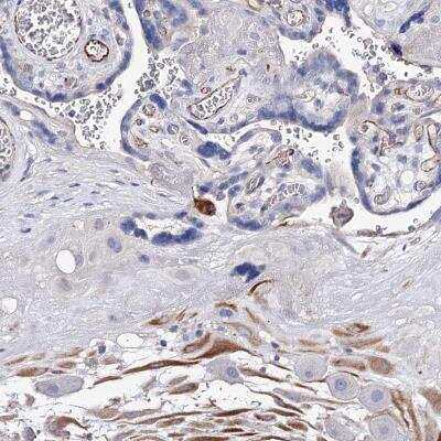 Immunohistochemistry-Paraffin: DSPG3/EPYC Antibody [NBP1-70338]