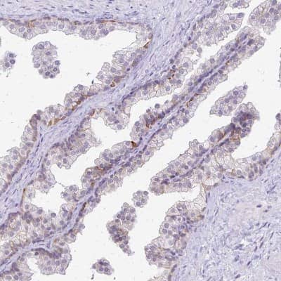 Immunohistochemistry-Paraffin: DSPG3/EPYC Antibody [NBP2-33445]