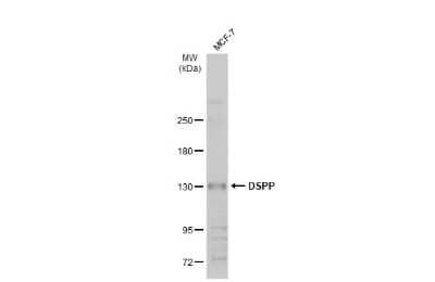 Western Blot: DSPP Antibody [NBP3-13388]