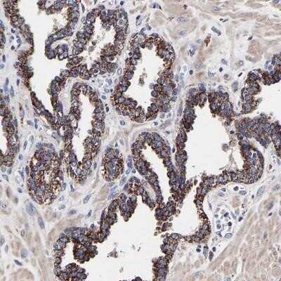 Immunohistochemistry-Paraffin: DSS1 Antibody [NBP1-91148]