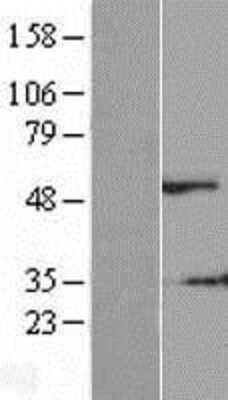 Western Blot: DSS1 Overexpression Lysate [NBP2-10419]