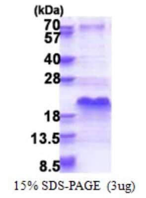 SDS-PAGE: Recombinant Human DSS1 His Protein [NBP2-22821]