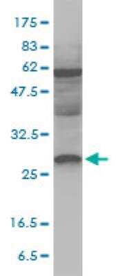 Western Blot: DSU Antibody (8F9-1B2) [H00055686-M01]