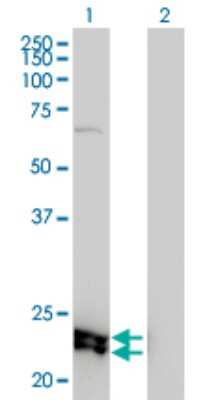 Western Blot: DSU Antibody (8F9-1B2) [H00055686-M01]