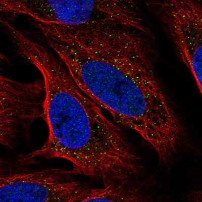 Immunocytochemistry/ Immunofluorescence: DSU Antibody [NBP2-55704]