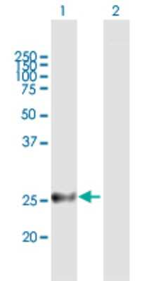 Western Blot: DSU Antibody [H00055686-B01P]