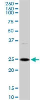 Western Blot: DSU Antibody [H00055686-D01P]
