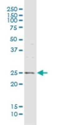 Western Blot: DSU Antibody [H00055686-D01P]
