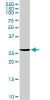 Western Blot: DSU Antibody [H00055686-D01P]