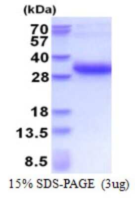 SDS-PAGE: Recombinant Human DSU His Protein [NBP2-51596]