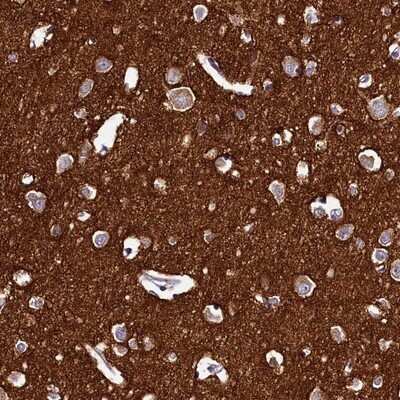 Immunohistochemistry-Paraffin: DTD1 Antibody [NBP1-88776]
