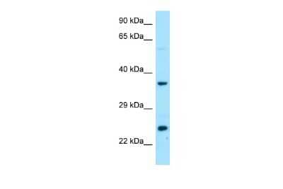 Western Blot: DTD1 Antibody [NBP2-35325]